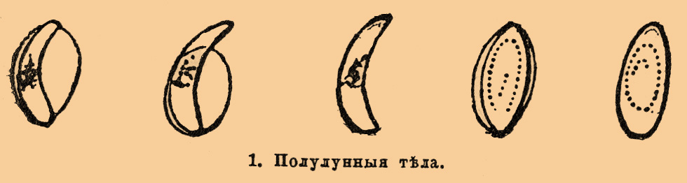 Малярия*