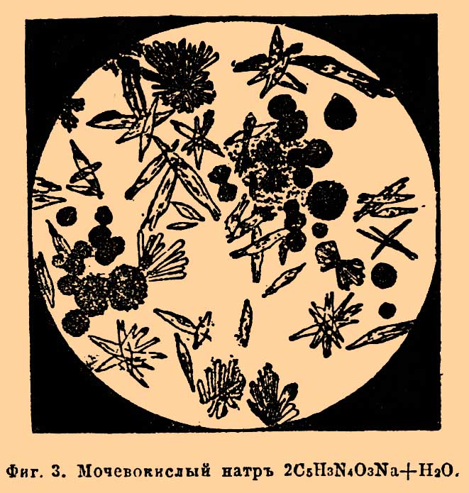 Мочевая кислота*
