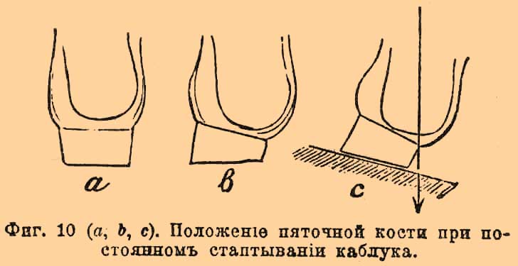 Обувь*