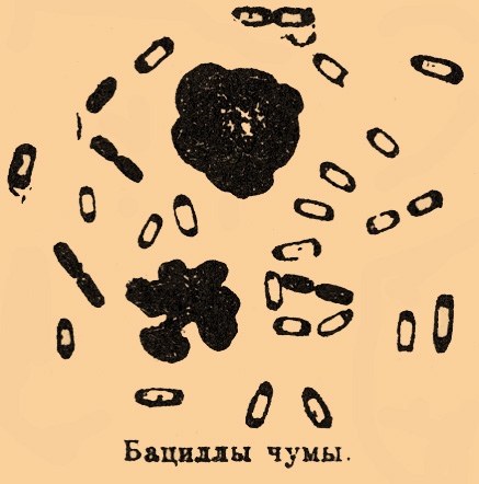Чума